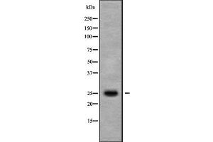 Image no. 1 for anti-Mitochondrially Encoded ATP Synthase 6 (MT-ATP6) (Internal Region) antibody (ABIN6263407)