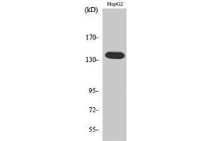 Image no. 1 for anti-Ataxin 2 (ATXN2) (Internal Region) antibody (ABIN3183407)