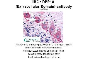 Image no. 1 for anti-Dipeptidylpeptidase 10 (DPP10) (Extracellular Domain) antibody (ABIN1733742)