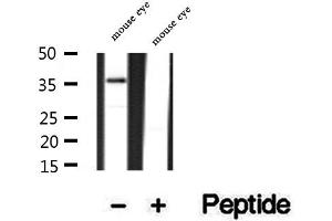 Image no. 2 for anti-Peripherin 2 (Retinal Degeneration, Slow) (PRPH2) (Internal Region) antibody (ABIN6264450)
