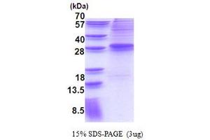 Image no. 1 for MDS1 and EVI1 Complex Locus (MECOM) (AA 1-169) protein (His tag) (ABIN6387329)