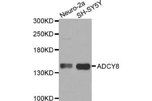 Image no. 1 for anti-Adenylate Cyclase 8 (Brain) (ADCY8) antibody (ABIN1870811)