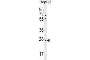 Image no. 2 for anti-Nuclear Receptor Subfamily 0, Group B, Member 2 (NR0B2) (AA 56-83), (Middle Region) antibody (ABIN953745)