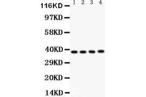 Image no. 3 for anti-NF-kappa-B inhibitor beta (NFKBIB) (AA 56-237) antibody (ABIN3043567)