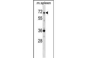 Image no. 1 for anti-SH3-Domain Binding Protein 2 (SH3BP2) (AA 151-180) antibody (ABIN5534681)