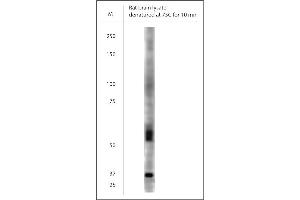 Image no. 3 for anti-Solute Carrier Family 17 (Vesicular Glutamate Transporter), Member 7 (SLC17A7) (AA 500-560) antibody (ABIN351379)
