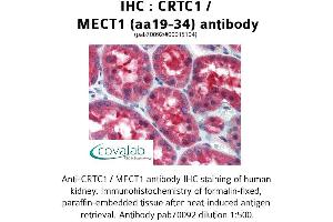 Image no. 1 for anti-CREB Regulated Transcription Coactivator 1 (CRTC1) (AA 19-34) antibody (ABIN1733326)