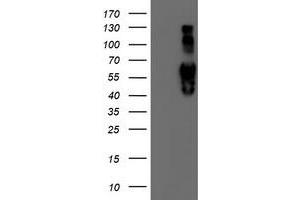 Image no. 2 for anti-Iduronate 2-Sulfatase (IDS) antibody (ABIN1498797)