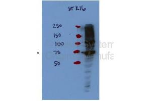 Image no. 2 for anti-serine/threonine Kinase 16 (STK16) (Middle Region) antibody (ABIN2783292)