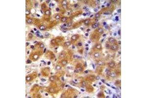Image no. 2 for anti-ATP-Binding Cassette, Sub-Family B (MDR/TAP), Member 10 (ABCB10) (AA 1-27) antibody (ABIN3030047)