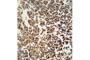 Image no. 1 for anti-Gametocyte Specific Factor 1 (GTSF1) (AA 44-74), (Middle Region) antibody (ABIN952660)