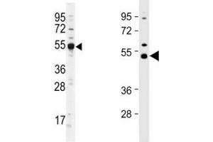 Image no. 1 for anti-tRNA Aspartic Acid Methyltransferase 1 (TRDMT1) (AA 346-375) antibody (ABIN3029268)