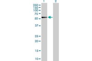 Image no. 2 for anti-Calcitonin Receptor (CALCR) (AA 1-474) antibody (ABIN513950)