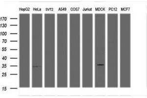 Image no. 2 for anti-Low Density Lipoprotein Receptor Adaptor Protein 1 (LDLRAP1) antibody (ABIN1496693)