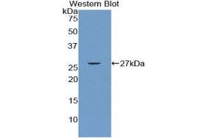 Image no. 1 for anti-CD79b Molecule, Immunoglobulin-Associated beta (CD79B) (AA 26-225) antibody (ABIN1859293)