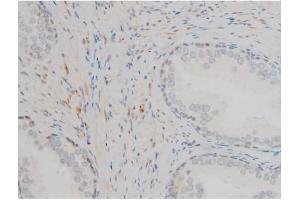 Image no. 5 for anti-GATA Binding Protein 1 (Globin Transcription Factor 1) (GATA1) (pSer142) antibody (ABIN6254982)
