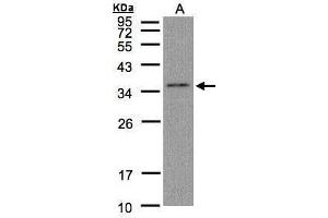 Image no. 3 for anti-Glyoxalase Domain Containing 4 (GLOD4) (Center) antibody (ABIN2855839)