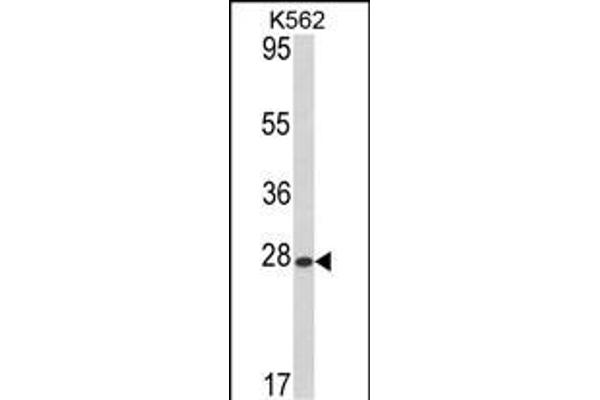ARL1 anticorps  (N-Term)