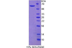 Image no. 1 for Sema Domain, Immunoglobulin Domain (Ig), Short Basic Domain, Secreted, (Semaphorin) 3E (SEMA3E) (AA 32-516) protein (His tag) (ABIN6236469)