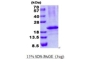 Image no. 1 for RCAN Family Member 3 (RCAN3) protein (His tag) (ABIN1098701)
