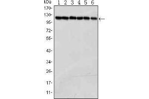 Image no. 1 for anti-Poly (ADP-Ribose) Polymerase 1 (PARP1) antibody (ABIN1724733)