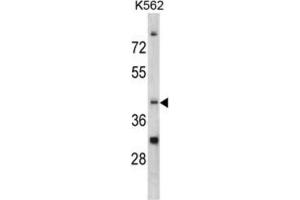 Image no. 1 for anti-CCR4 Carbon Catabolite Repression 4-Like (CCRN4L) antibody (ABIN3002711)