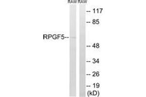 Image no. 1 for anti-Rap Guanine Nucleotide Exchange Factor (GEF) 5 (RAPGEF5) (AA 431-480) antibody (ABIN1535258)