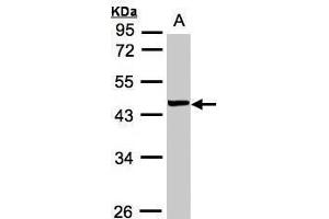 Image no. 1 for anti-Vacuolar Protein Sorting 72 Homolog (S. Cerevisiae) (VPS72) (Center) antibody (ABIN2855301)