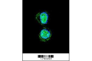 Image no. 1 for anti-Homeobox A10 (HOXA10) (AA 244-271) antibody (ABIN654234)