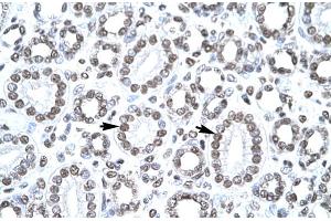 Image no. 4 for anti-Cbp/p300-Interacting Transactivator, with Glu/Asp-Rich Carboxy-terminal Domain, 1 (CITED1) (Middle Region) antibody (ABIN2777537)