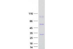 Image no. 1 for Methyltransferase Like 7A (METTL7A) protein (Myc-DYKDDDDK Tag) (ABIN2725895)