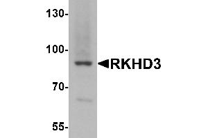 Western blot analysis of RKHD3 in mouse skeletal muscle tissue lysate with RKHD3 antibody at 1 µg/mL.