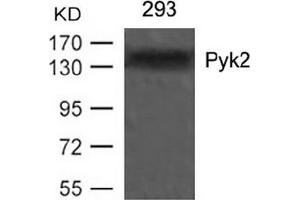 Image no. 3 for anti-PTK2B Protein tyrosine Kinase 2 beta (PTK2B) (Tyr402) antibody (ABIN197440)
