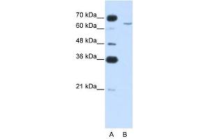 Image no. 1 for anti-Cytoplasmic Polyadenylation Element Binding Protein 2 (CPEB2) (N-Term) antibody (ABIN633424)