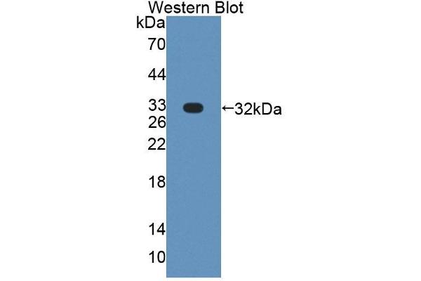 PLCH1 Antikörper  (AA 1-237)
