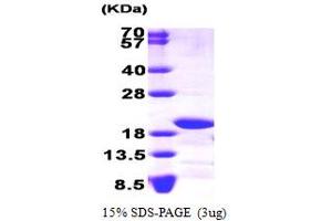 Image no. 1 for NADH Dehydrogenase (Ubiquinone) Fe-S Protein 4, 18kDa (NADH-Coenzyme Q Reductase) (NDUFS4) (AA 43-175) protein (ABIN667110)