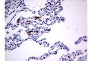 Image no. 2 for anti-Tumor Necrosis Factor Receptor Superfamily, Member 8 (TNFRSF8) (AA 19-379) antibody (ABIN1491085)