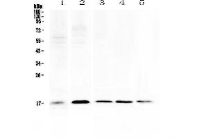 Image no. 1 for anti-S100 Calcium Binding Protein A7 (S100A7) (AA 2-101) antibody (ABIN5692925)