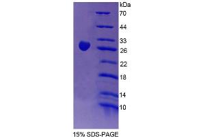Image no. 1 for Chimerin (Chimaerin) 2 (CHN2) (AA 101-323) protein (His tag) (ABIN6239086)