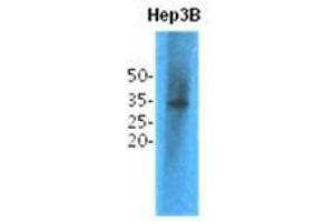 Image no. 2 for anti-Thiopurine S-Methyltransferase (TPMT) antibody (ABIN781549)