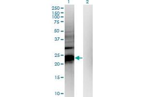 HDHD1 antibody  (AA 107-212)
