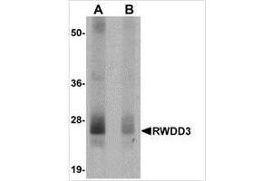 Image no. 1 for anti-RWD Domain Containing 3 (RWDD3) (N-Term) antibody (ABIN783831)