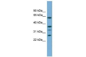 Image no. 1 for anti-Apolipoprotein L, 2 (APOL2) (Middle Region) antibody (ABIN928303)