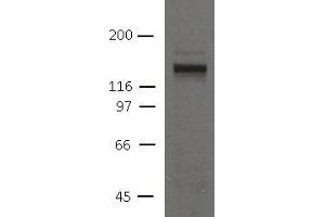 Image no. 1 for anti-Desmoglein 2 (DSG2) (AA 37-164), (N-Term) antibody (ABIN1169682)