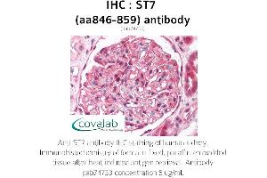 Image no. 1 for anti-Suppression of Tumorigenicity 7 (ST7) (AA 846-859) antibody (ABIN1739683)
