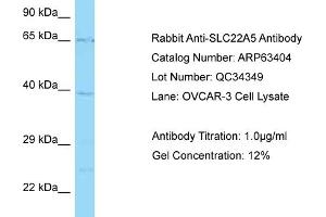 Image no. 1 for anti-Solute Carrier Family 22 Member 5 (SLC22A5) (C-Term) antibody (ABIN2789486)