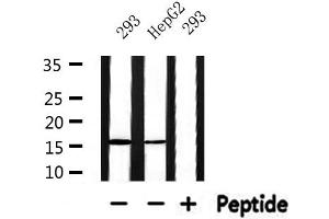 RPS19 antibody  (Internal Region)