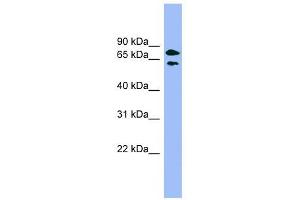 Image no. 1 for anti-Pantothenate Kinase 4 (PANK4) (Middle Region) antibody (ABIN631284)