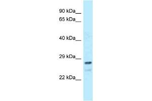 Image no. 1 for anti-FK506 Binding Protein 14, 22 KDa (FKBP14) (Middle Region) antibody (ABIN2774348)