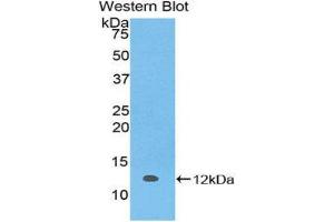 Image no. 1 for anti-S100 Calcium Binding Protein A5 (S100A5) (AA 1-93) antibody (ABIN3201664)